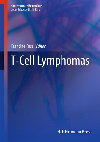 T-Cell Lymphomas - Francine Foss