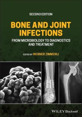 Bone and Joint Infections - 