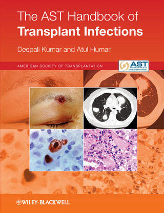 The AST Handbook of Transplant Infections - Deepali Kumar; Atul Humar