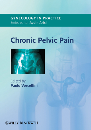 Chronic Pelvic Pain - Paolo Vercellini
