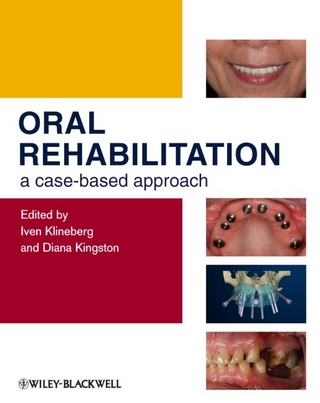 Oral Rehabilitation - Iven Klineberg; Diana Kingston