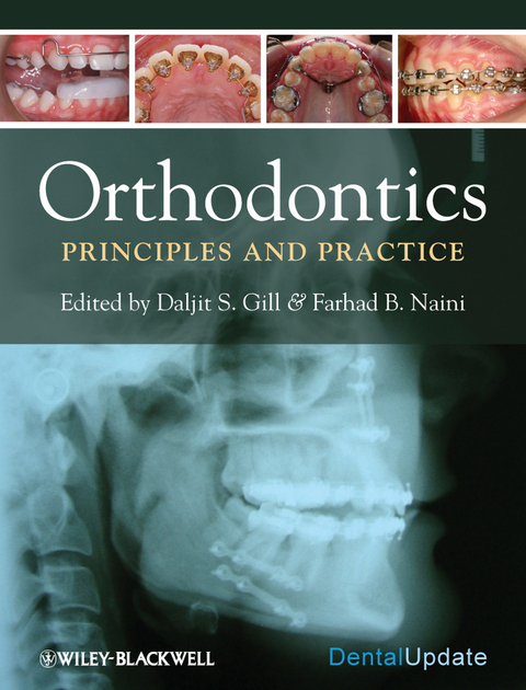 Orthodontics - Daljit S. Gill, Farhad B. Naini