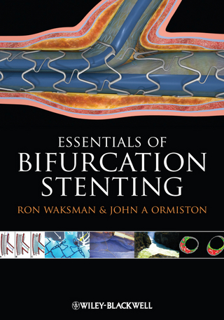 Bifurcation Stenting - Ron Waksman; John Ormiston