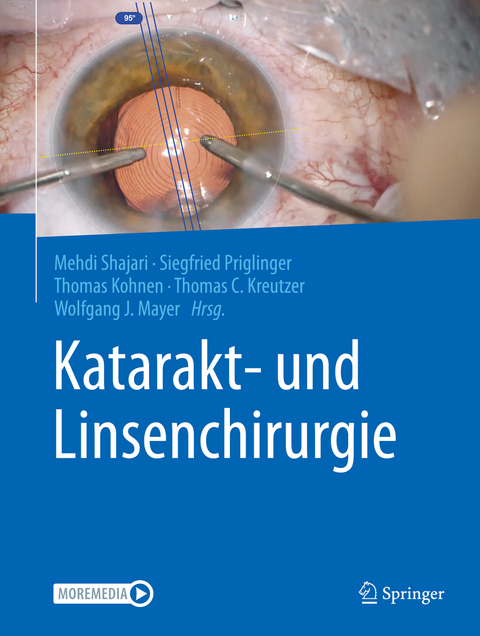 Katarakt- und Linsenchirurgie - 