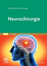 Neurochirurgie - Schirmer, Michael