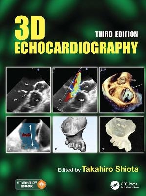 3D Echocardiography - 
