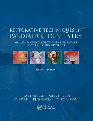 Restorative Techniques in Paediatric Dentistry - M.S. Duggal, M.E.J Cuzon, S.A. Fayle, K.J Toumba, A.J. Robertson