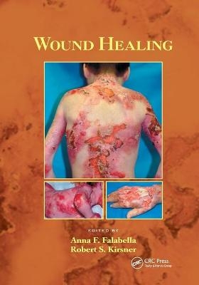 Wound Healing - Anna Falabella; Robert Kirsner