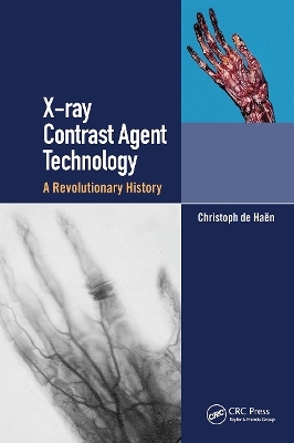 X-ray Contrast Agent Technology - Christoph de Haen