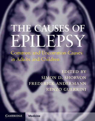 Causes of Epilepsy - Frederick Andermann; Renzo Guerrini; Simon D. Shorvon