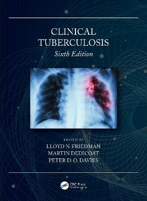 Clinical Tuberculosis - 