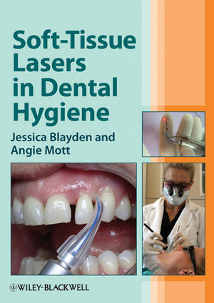 Soft-Tissue Lasers in Dental Hygiene -  Jessica Blayden,  Angie Mott