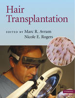 Hair Transplantation - Marc R. Avram; Nicole E. Rogers
