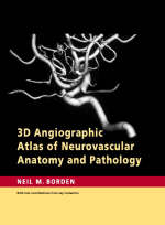 3D Angiographic Atlas of Neurovascular Anatomy and Pathology -  Neil M. Borden