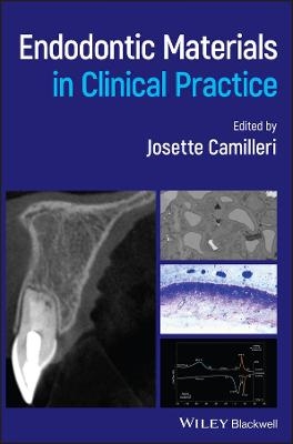 Endodontic Materials in Clinical Practice - 