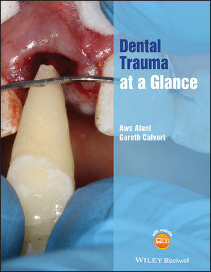 Dental Trauma at a Glance - Aws Alani, Gareth Calvert