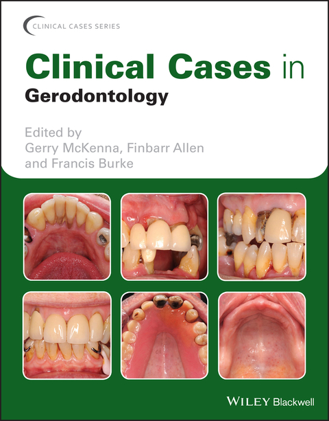Clinical Cases in Gerodontology - 