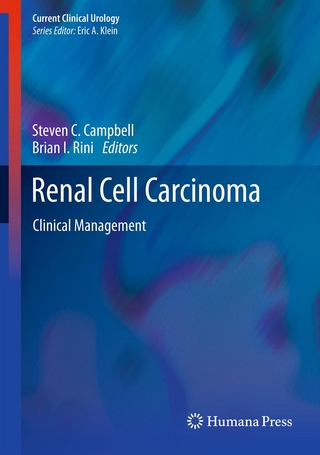 Renal Cell Carcinoma - Steven C. Campbell; Brian I. Rini