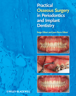 Practical Osseous Surgery in Periodontics and Implant Dentistry - Serge Dibart; Jean-Pierre Dibart