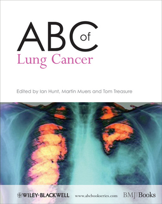 ABC of Lung Cancer - Ian Hunt; Martin M; Muers; Tom Treasure