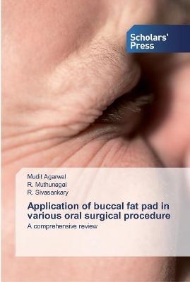 Application of buccal fat pad in various oral surgical procedure - Mudit Agarwal, R Muthunagai, R Sivasankary