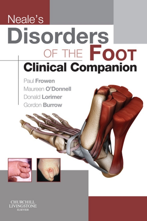 Neale's Disorders of the Foot Clinical Companion -  J. Gordon Burrow,  Paul Frowen,  Donald L. Lorimer,  Maureen O'Donnell