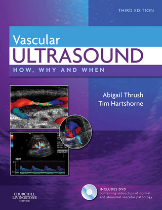 Vascular Ultrasound - Abigail Thrush; Abigail Thrush; Timothy Hartshorne; Timothy Hartshorne