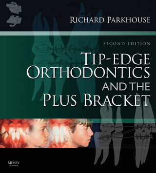 Tip-Edge Orthodontics and the Plus Bracket E-Book - Richard Parkhouse