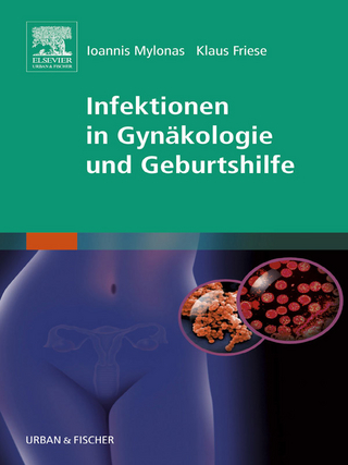 Infektionen in Gynäkologie und Geburtshilfe - Ioannis Mylonas; Klaus Friese
