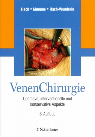 Venen Chirurgie - Wolfgang Hach; Achim Mumme; Viola Hach-Wunderle