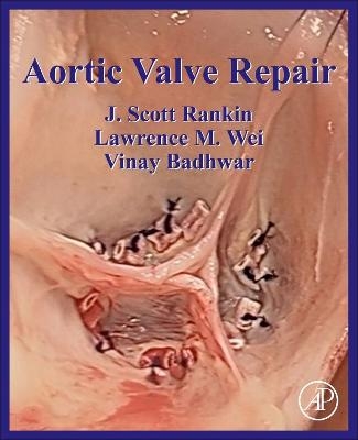 Aortic Valve Repair - J Scott Rankin