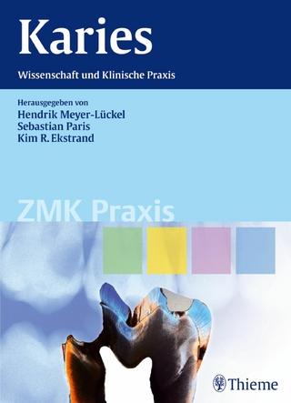 Karies - Hendrik Meyer-Lückel; Sebastian Paris; Kim Ekstrand