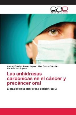Las anhidrasas carbónicas en el cáncer y precáncer oral - Manuel Eusebio Torres López, Abel García García, Mario Pérez-Sayáns