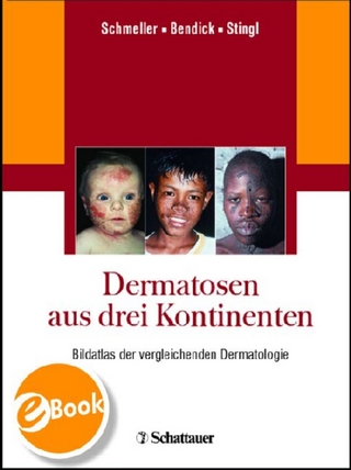 Dermatosen aus drei Kontinenten - Wilfried Schmeller; Christoph Bendick; Peter Stingl