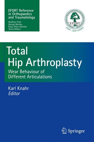 Total Hip Arthroplasty - Karl Knahr