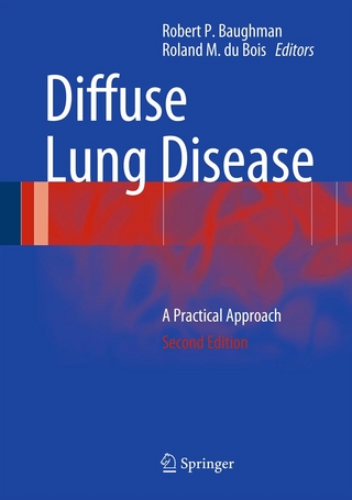 Diffuse Lung Disease - Robert P. Baughman; Roland M. du Bois