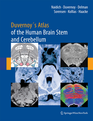Duvernoy's Atlas of the Human Brain Stem and Cerebellum - Thomas P. Naidich; Henri M. Duvernoy; Bradley N. Delman; A. Gregory Sorensen; Spyros S. Kollias; E.