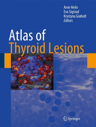 Atlas of Thyroid Lesions - Krystyna Groholt; Arne Heilo; Eva Sigstad