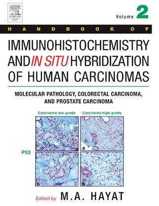 Handbook of Immunohistochemistry and in Situ Hybridization of Human Carcinomas - M. A. Hayat