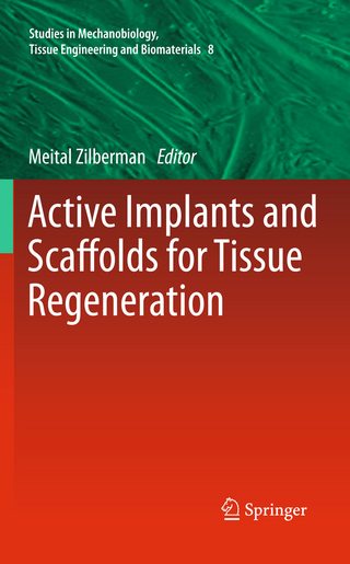 Active Implants and Scaffolds for Tissue Regeneration - Meital Zilberman