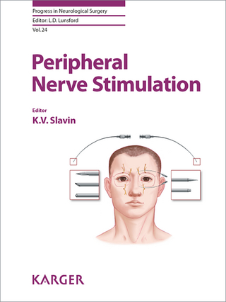 Peripheral Nerve Stimulation - K.V. Slavin