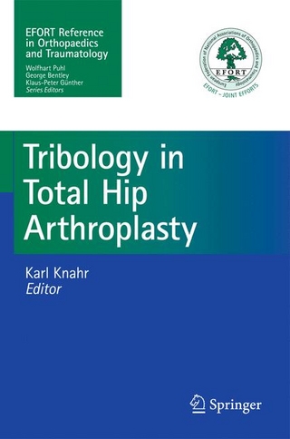 Tribology in Total Hip Arthroplasty - Karl Knahr