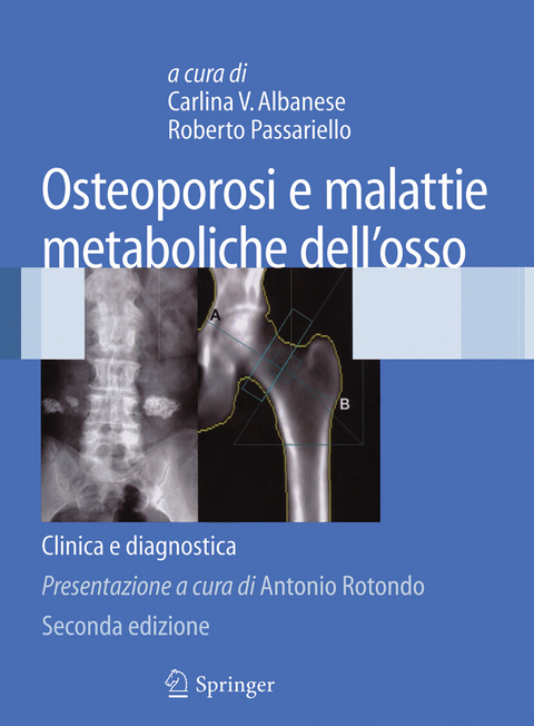 Osteoporosi e malattie metaboliche dell''osso - 