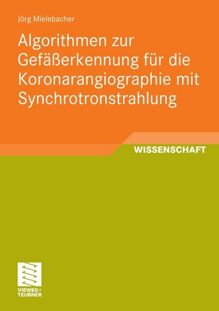Algorithmen zur Gefäßerkennung für die Koronarangiographie mit Synchrotronstrahlung - Jörg Mielebacher
