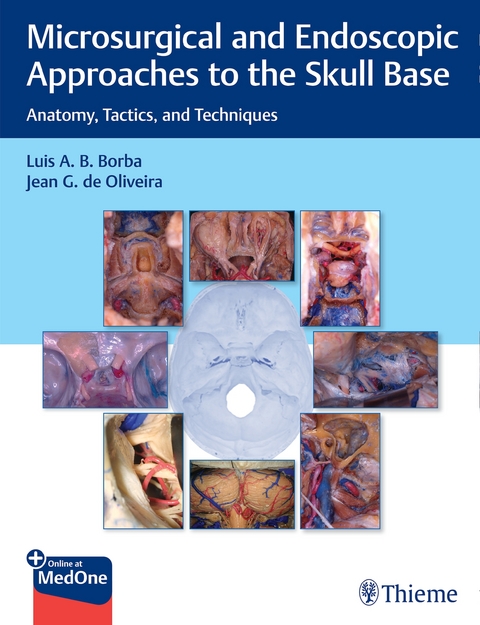 Microsurgical and Endoscopic Approaches to the Skull Base - Luis Borba, Jean de Oliveira
