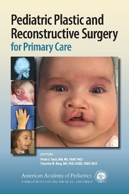 Pediatric Plastic and Reconstructive Surgery for Primary Care - 