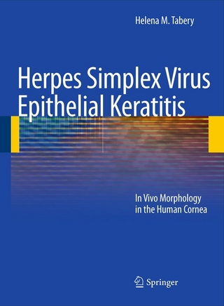 Herpes Simplex Virus Epithelial Keratitis - Helena M. Tabery