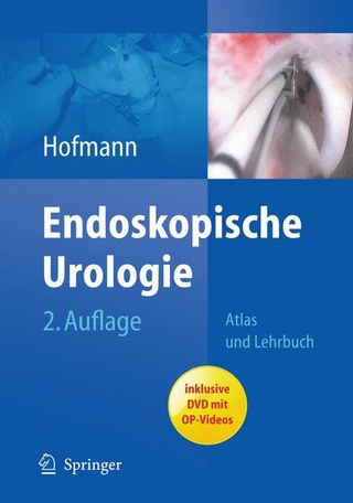 Endoskopische Urologie - Rainer Hofmann; Rainer Hofmann