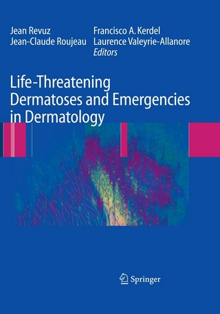 Life-Threatening Dermatoses and Emergencies in Dermatology - Jean Revuz; Jean-Claude Roujeau; Francisco Kerdel; Laurence Valeyrie-Allanore