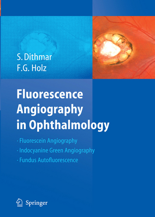 Fluorescence Angiography in Ophthalmology - Stefan Dithmar; Frank G. Holz